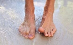 walking barefoot as a cause of fungus