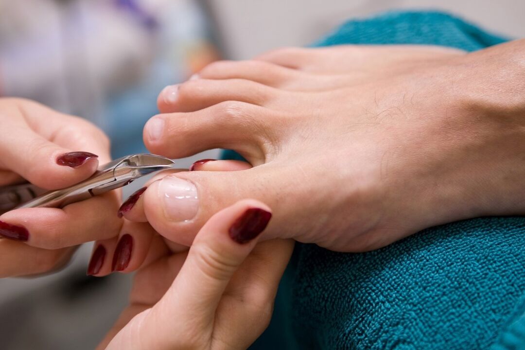 pedicure as a way to infect the fungus on the nails