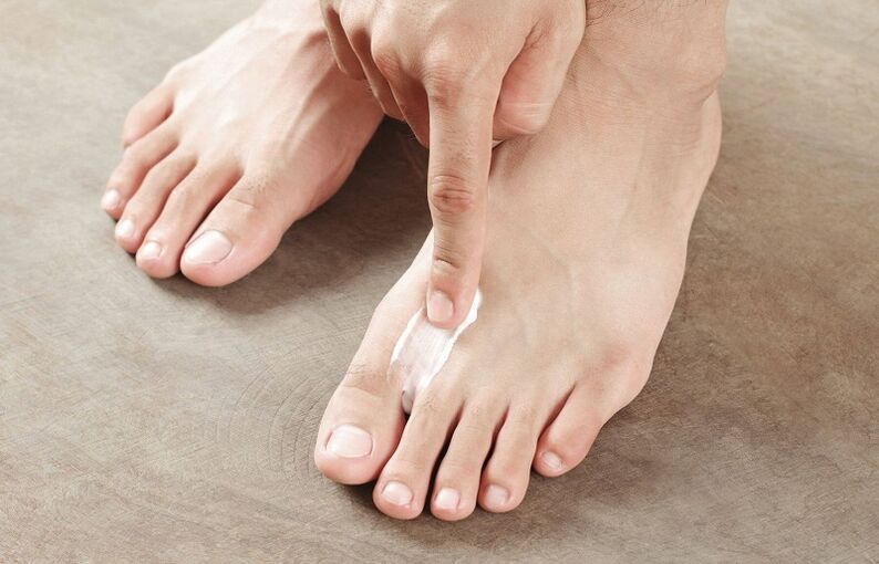 ointment to treat toenail fungus
