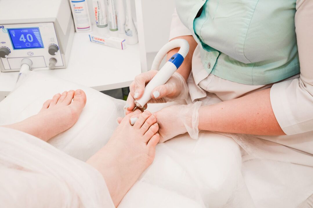 treatment of nail fungus with a doctor