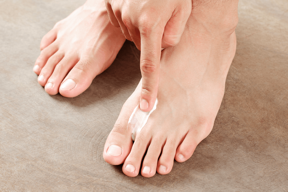 treatment of fungus between the toes