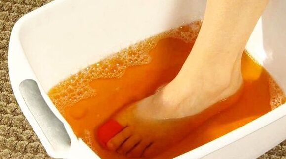 iodine bath against foot fungus