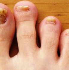 Footfoot