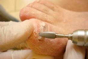 Mechanical cutting of nail plates