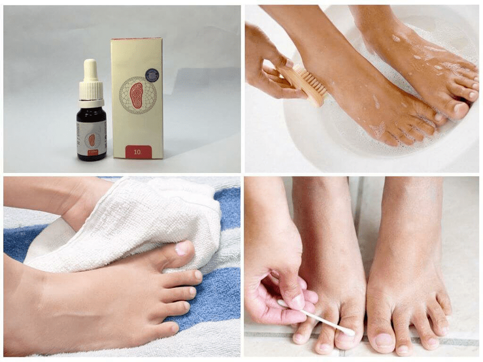 Different drugs for feet fungal