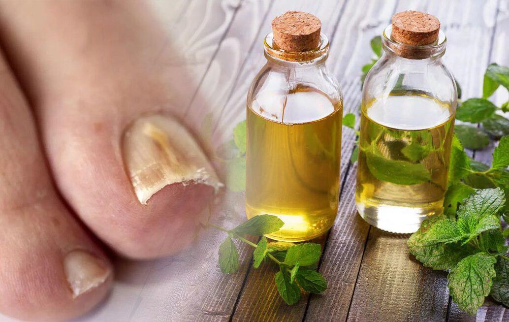 vinegar for nail fungi