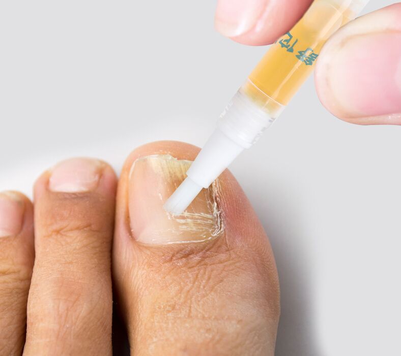 toenail fungus liquid